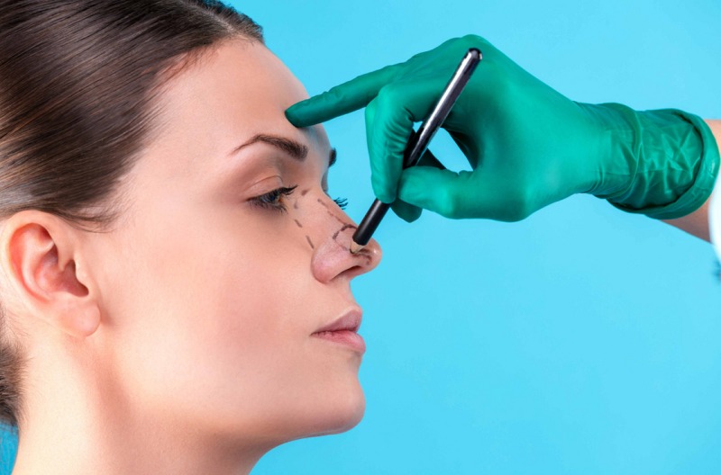 5 Common Myths about Rhinoplasty